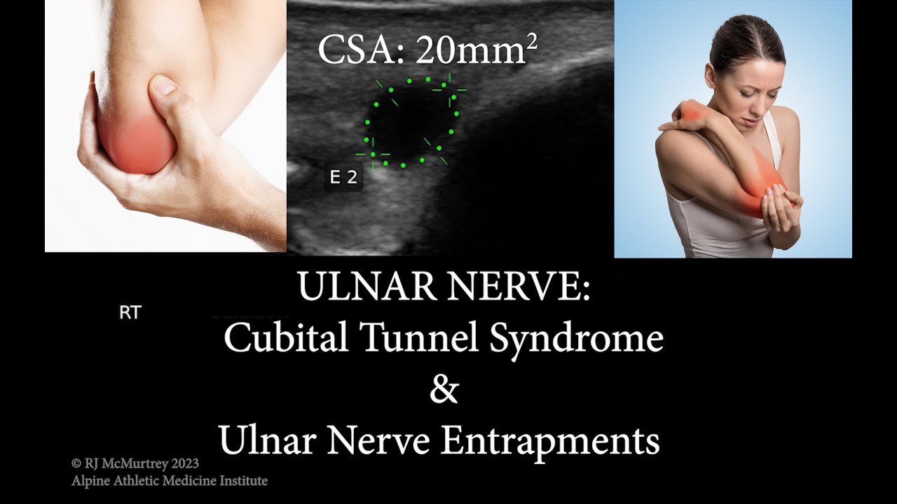 bpc 157 for nerve damage Alpine Spine & Orthopedics