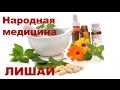 Народные средства от лишая