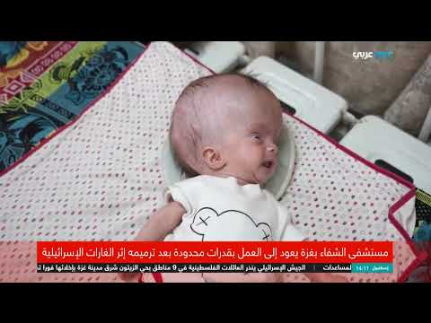 مستشفى الشفاء بغزة: عمل محدود في ظل نقص حاد