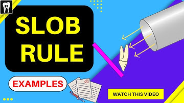 SLOB Rule/ Buccal Object Rule/ Oral Radiology/ Dental radiology/ INBDE / NBDE