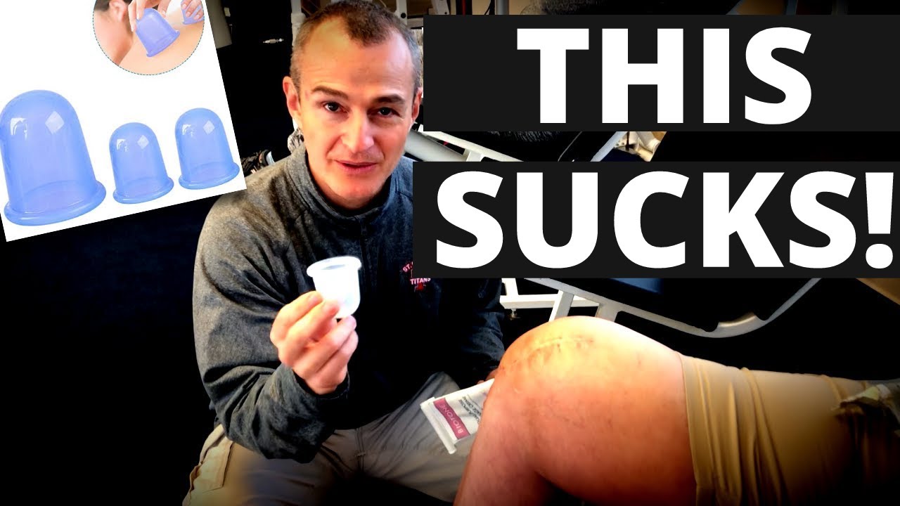 Scar Tissue Massage & Improve Range of Motion With Cupping YouTube