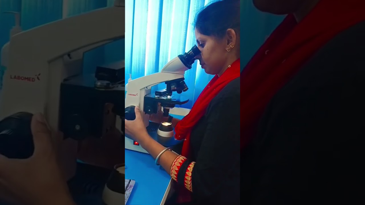 ##🔬sputum test for AFB
