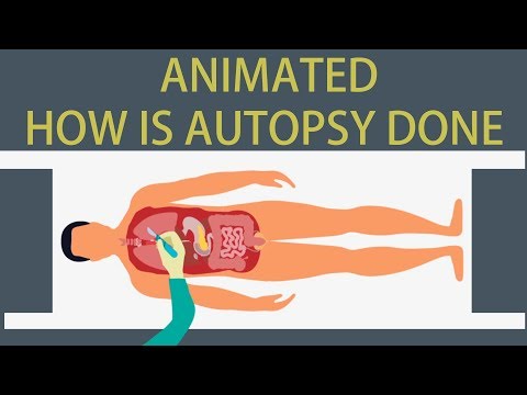 Autopsy :Detailed animation on how is Autopsy done