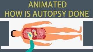 Autopsy :Detailed animation on how is Autopsy done
