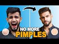 GET RID OF PIMPLES &amp; ACNE | Best Products for OILY SKIN | Remove Acne Marks &amp; Dark Spots