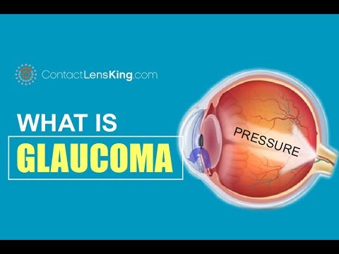 What is Glaucoma and Intraocular Pressure?