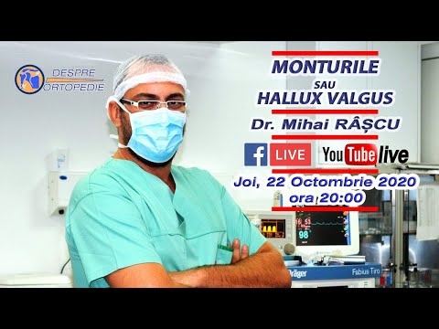 Monturile  sau  Hallux Valgus