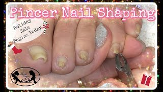 Pedicure Tutorial How to Cut and Shape Pincer Toenails at Home
