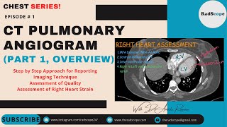 CT Pulmonary Angiogram (Part 1, Overview) screenshot 4