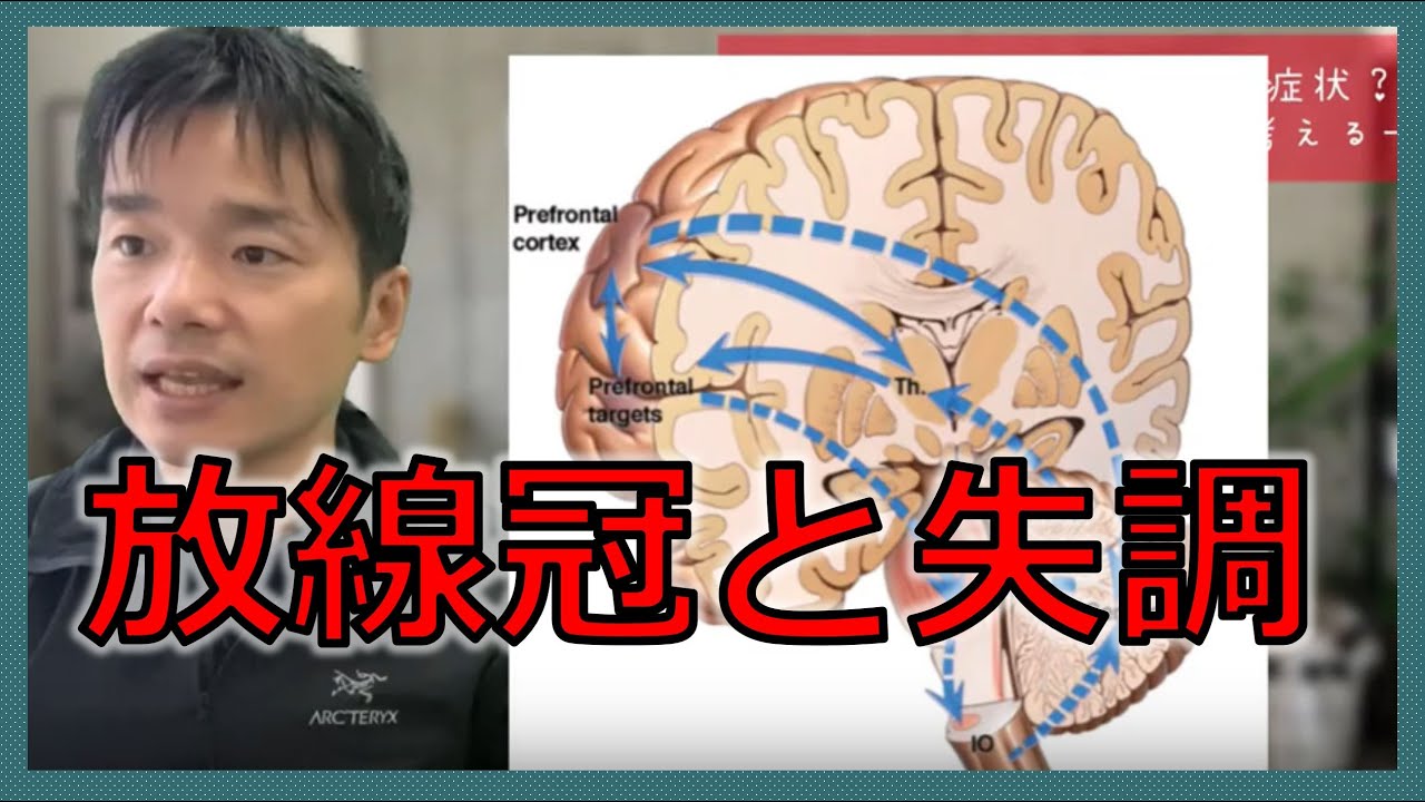 放線冠/視床/橋の失調症状と小脳性失調は何が違うの？予後予測と脳科学