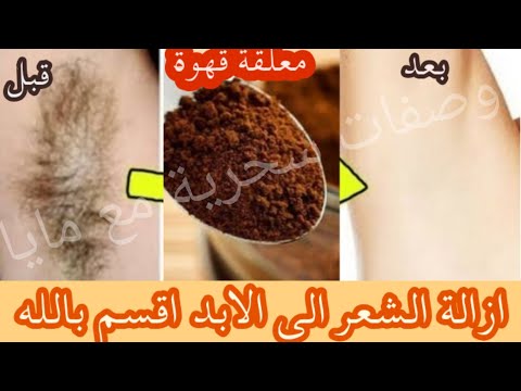 إزالة شعر الوجه والجسم ليلة العيد من أول استخدام في ربع ساعة من غير سويت ولا شفرات ولا وجع نهائياً. 