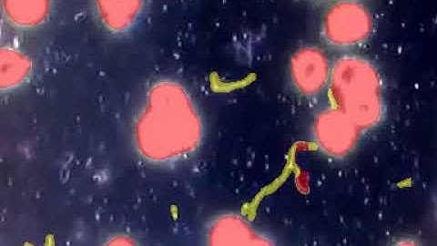 Image segmentation with deep neural network (UNet/Unet++) - Spirochaeta detection in blood sample