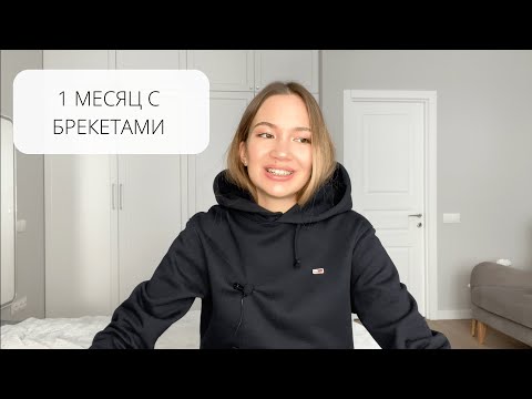 1 МЕСЯЦ С БРЕКЕТАМИ 😬: УЖЕ ВЫРАВНИВАЕТСЯ? | ПИТАНИЕ