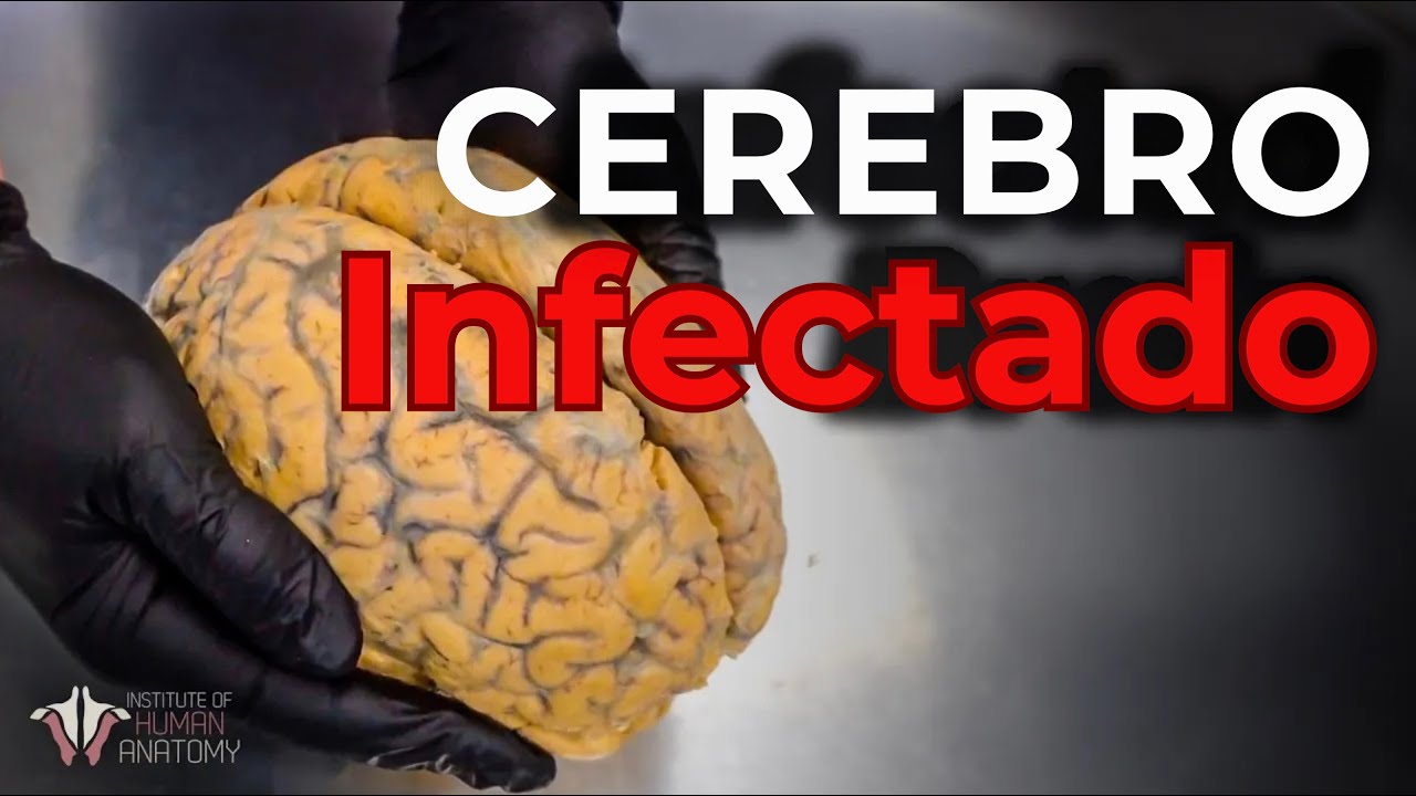 LA RABIA: el virus más peligroso