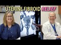 How are Uterine Fibroids Treated?