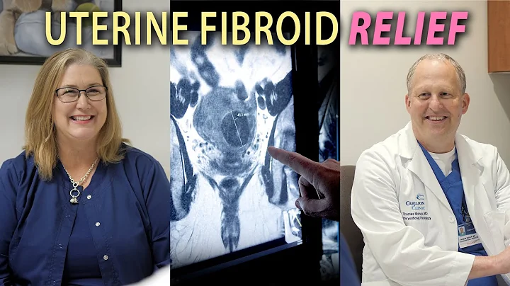 How are Uterine Fibroids Treated? - DayDayNews