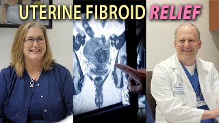 How are Uterine Fibroids Treated? screenshot 3