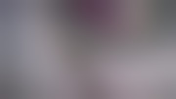 “Iris Shelf” technique to remove intraocular foreign body *Narration*