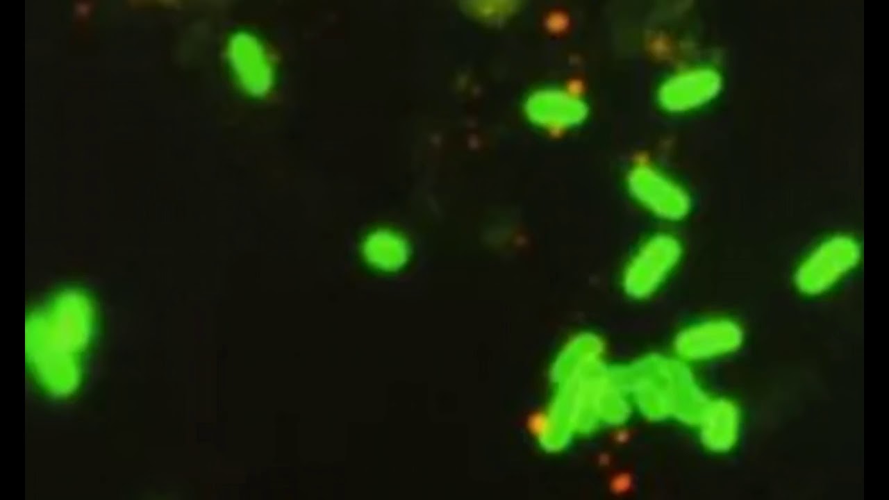 Health Alert! E coli Found at Tennessee Zipline Attraction, More Than ...