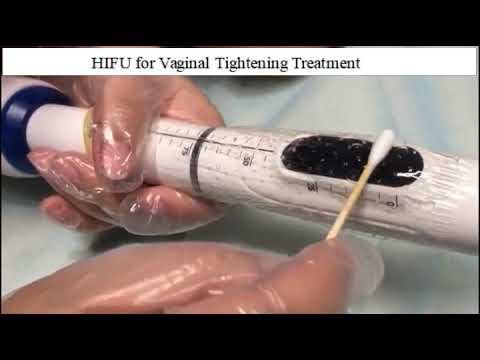 Video: Vagina - Wände, Struktur, Krankheiten