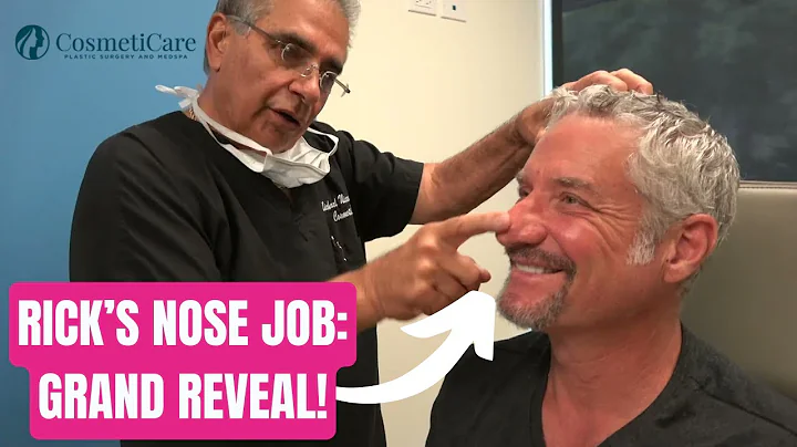 RICKS NOSE JOB: GRAND REVEAL!