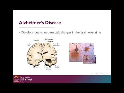 Alzheimer&rsquo;s Caregiving During the Holidays - Professional Caregiver Webinar