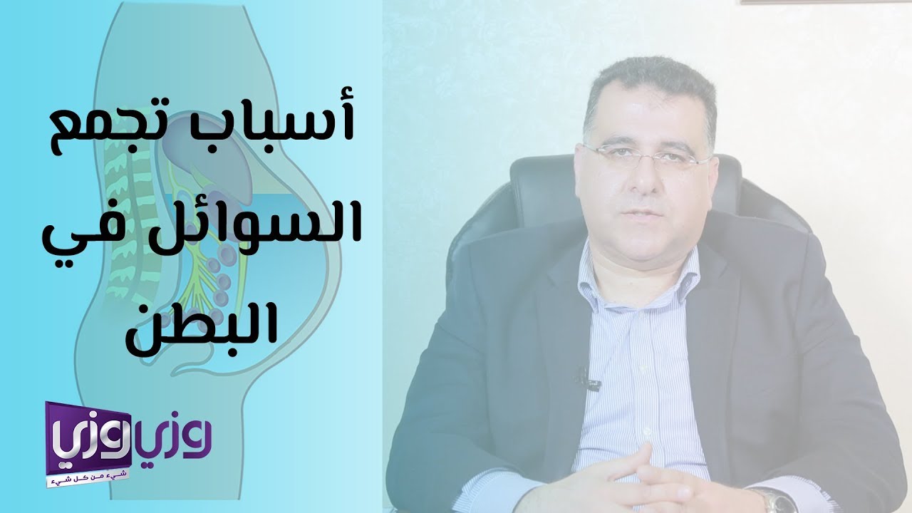أسباب تجمع السوائل في البطن