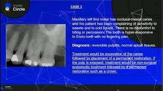 Pulp and Periapical Diagnosis - Endodontics - Radiographic Interpretation