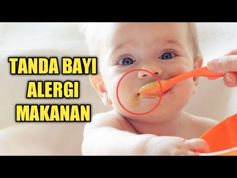 Tanda-tanda Bayi Mengalami Alergi Makanan