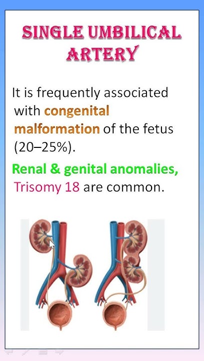 tips-31-single-umbilical-artery-in-tamil-define-causes-reason