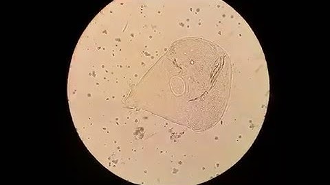 Termite Gut Microbes