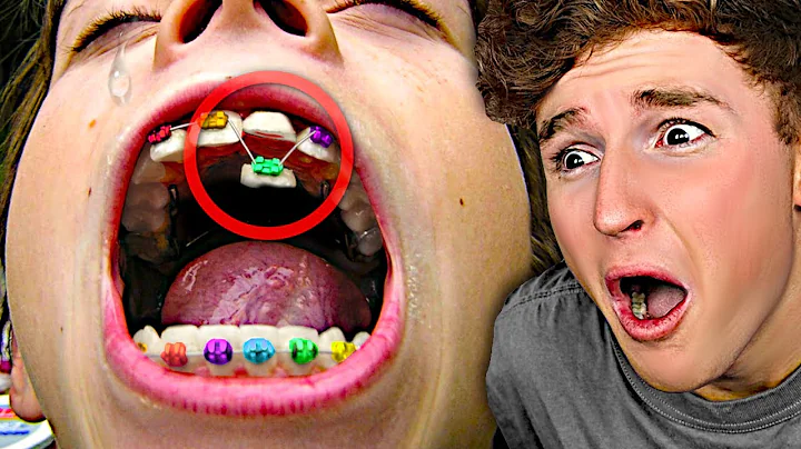 All Your PAIN In One Video..