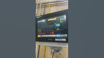 Cardiac monitor #norcet #nursing #medical #viral #short #philips
