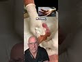 Listen for the POP 🔊DUPUYTREN&rsquo;S Contracture Quick Fix #shorts