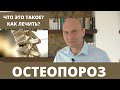 ОСТЕОПОРОЗ: что это такое? как его диагностировать? как лечить?