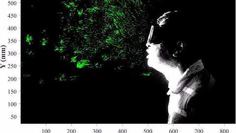 Particle Tracking Velocimetry (PTV) of a Human Sneeze