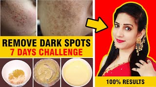 In 7 Days  Remove DARK SPOTS, ACNE SCARS, PIMPLE MARKS, PIGMENTATION in just 7 Days | 100% Results