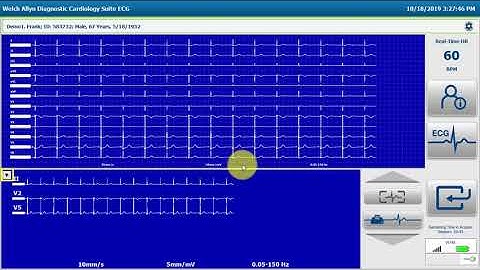 Welch Allyn® Diagnostic Cardiology Suite™ Resting ECG Workflow