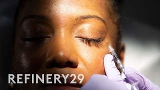 I Got Botox Injections for the First Time | Macro Beauty | Refinery29