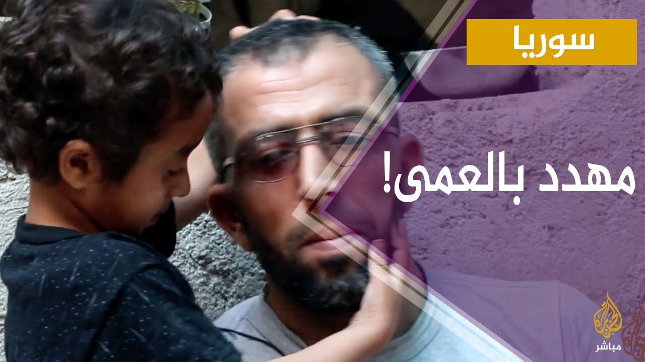 حكاية سوري يفقد البصر بسبب عمله فهل يستمر فيه 😰 ؟!