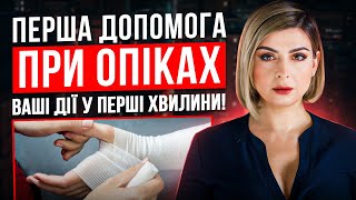 Опіки? Як допомогти і не нашкодити!