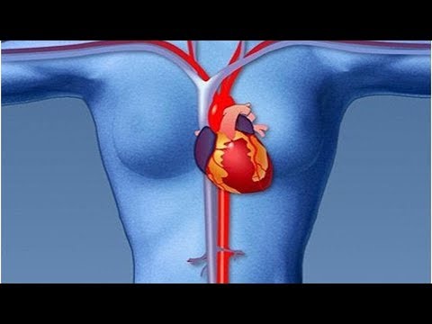 Video: Hjärtattack Symptom Hos Män Och Kvinnor