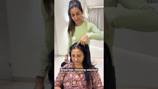 Front Hair Thinning Solution For Low Volume &amp; Bald Spots | Cover Instantly Using Cover Up Hair Patch