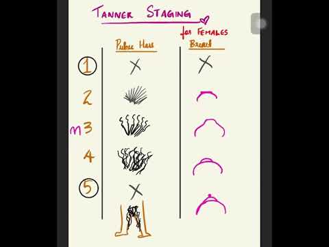 Video: Cos'è un Tanner stage 5?