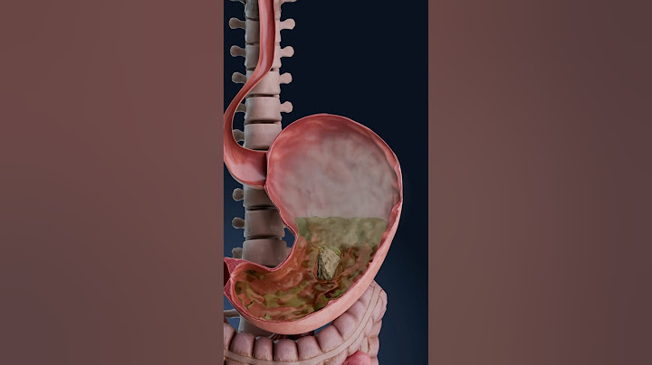 Visualización 3D de la distensión abdominal: ¿qué está ocurriendo en tu cuerpo?