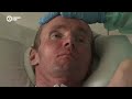 Ukrainian Soldier Fights On At Spanish Clinic After Losing Part Of His Skull