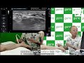 運動器超音波解剖ハンズオン 後編 下肢～まとめ（林 典雄 先生）