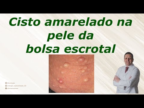 Cisto amarelado na pele da bolsa!