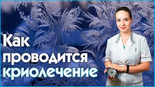 Врач-отоларинголог - Криолечение