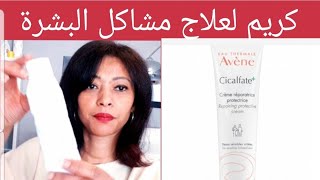 Avène cicalfate  أشهر كريمات ترميم البشرة علاج/ آثار الحبوب الندوب،الحروق،التصبغات/ مع خبيرة التجميل